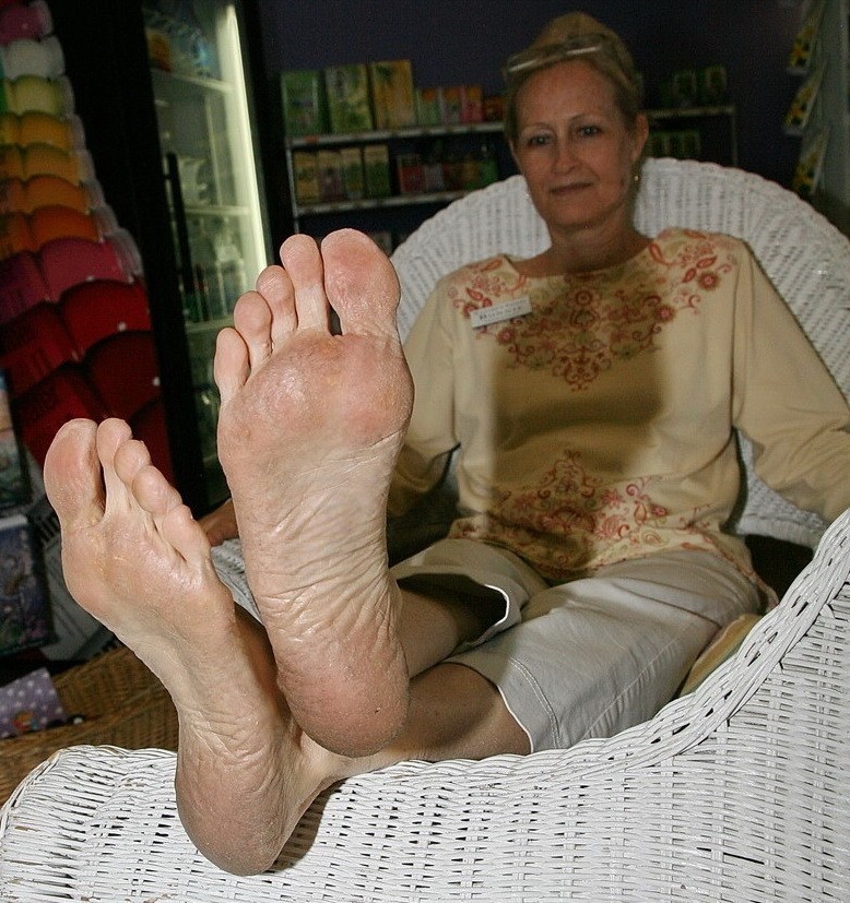 Mature Feet Worship - Mature Foot Fetish Porn Image 189571
