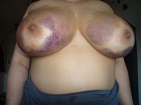 mature gals porn galleries nude fat woman ass plumper gals fatty blowjobs